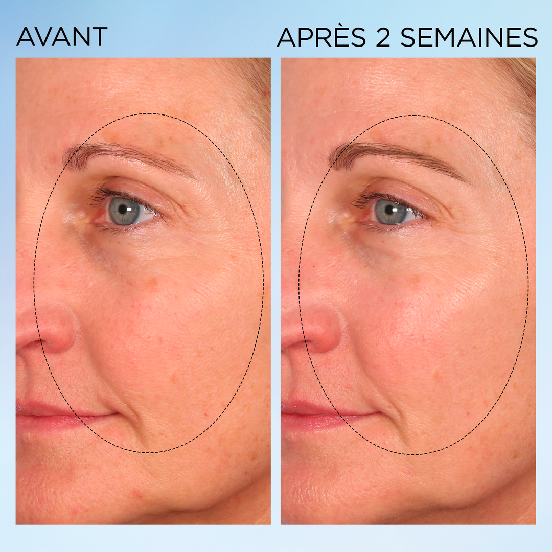 Visible Brightening Capsules Sérum Correctrices Anti-taches Booster d’Éclat