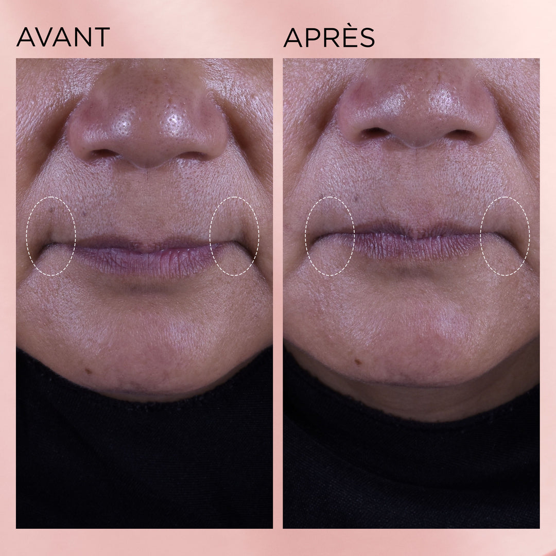 Rétinol + HPR Ceramide Aqua-Crème Régénérante