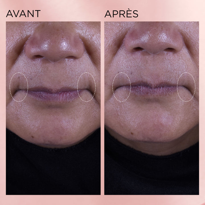Rétinol + HPR Ceramide Aqua-Crème Régénérante